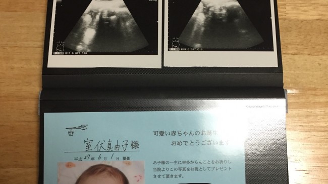 《マタニティライフの思い出♡》みんなどうしている? 妊娠中のエコー写真のまとめ方