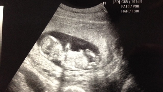 《トントン、ニョロニョロ…》お腹の赤ちゃんは今何してるの? 胎動からわかる赤ちゃんのこと