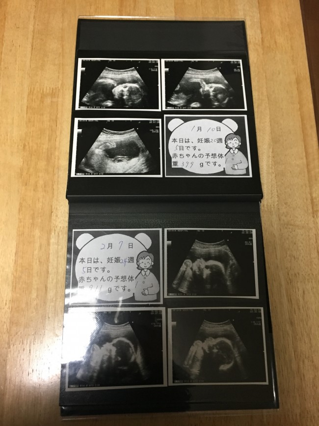 マタニティライフの思い出 みんなどうしている 妊娠中のエコー写真のまとめ方 代官山スタイル By Blossom39