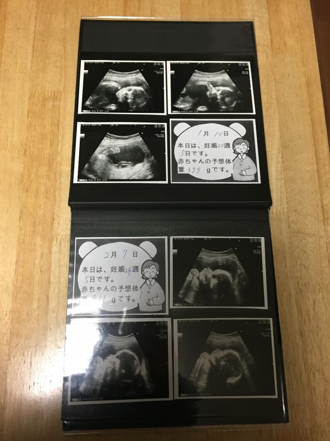 マタニティライフの思い出 みんなどうしている 妊娠中のエコー写真のまとめ方 代官山スタイル By Blossom39 マタニティライフの思い出 みんなどうしている 妊娠中のエコー写真のまとめ方 代官山スタイル By Blossom39