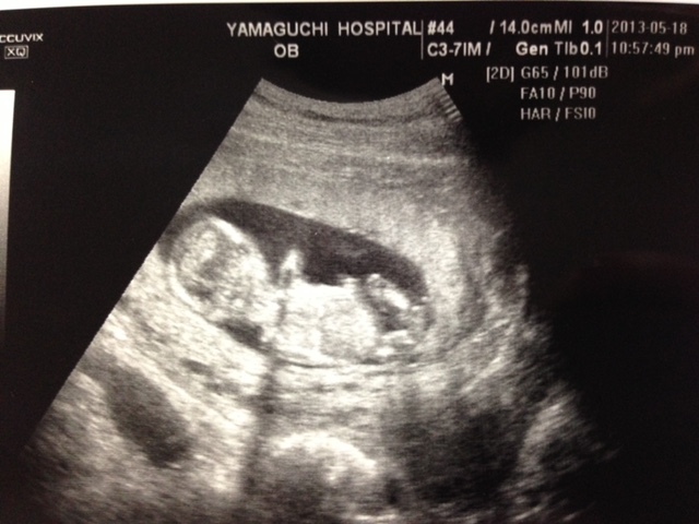 トントン ニョロニョロ お腹の赤ちゃんは今何してるの 胎動からわかる赤ちゃんのこと 代官山スタイル By Blossom39
